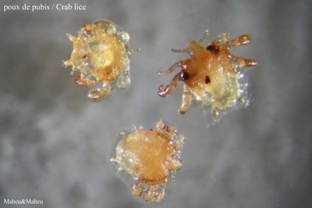 Crab Louse