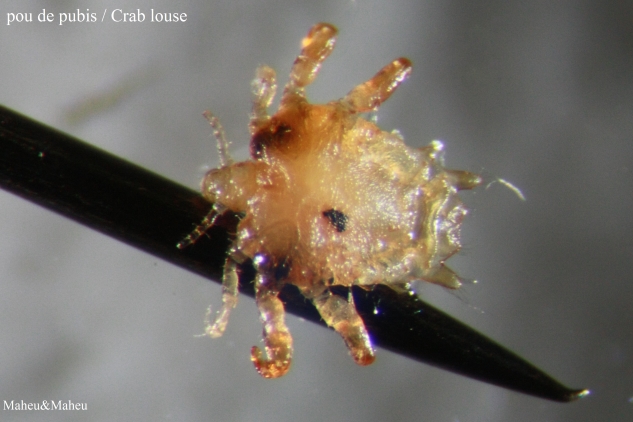 Crab Louse