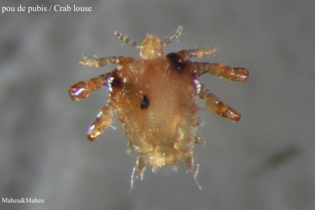 Crab Louse